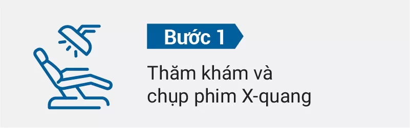 quy trình nhổ răng khôn