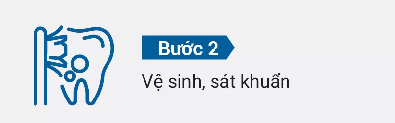 Quy trình nhổ răng khôn