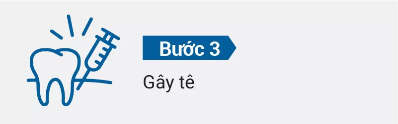 Quy trình nhổ răng khôn