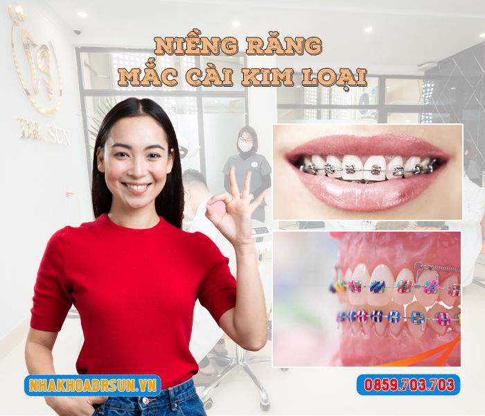 nieng-rang-mac-cai-kim-loai