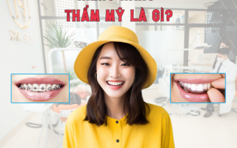 Niềng răng Thẩm Mỹ – Giải pháp mang lại hàm răng hoàn hảo