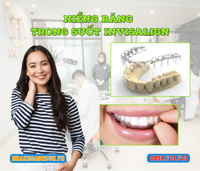 nieng-rang-trong-suot-invisalign