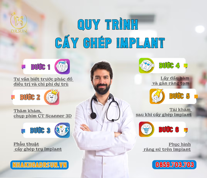 quy trinh cay ghep implant