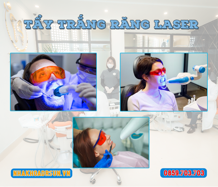 tay-trang-rang-laser