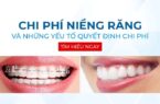 chi phí niềng răng bao nhiêu tiền