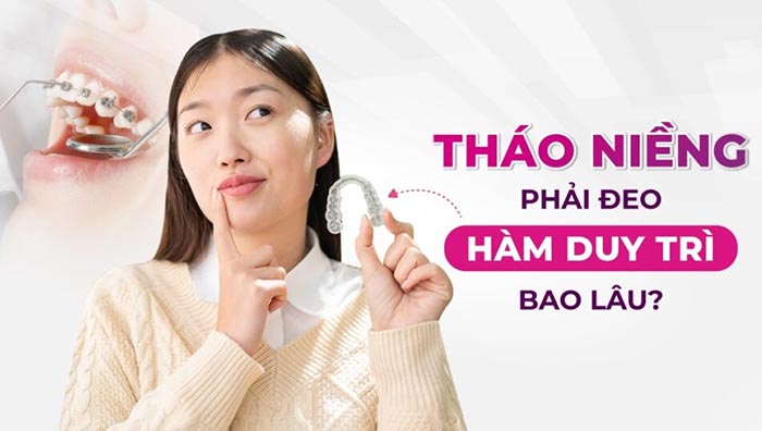 thời gian đeo hàm duy trì bao lâu
