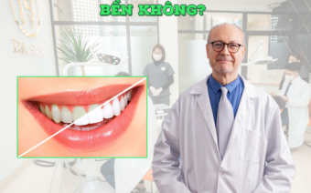 Bọc răng sứ có bền không? Duy trì được bao lâu?