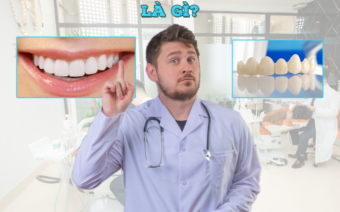 Bọc răng sứ thẩm mỹ là gì? Có tốt không?