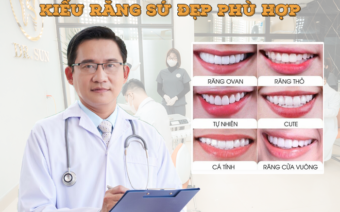 Top 5 Form răng sứ đẹp được sử dụng nhiều nhất