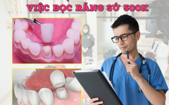 Bọc răng sứ giá rẻ 500k có nên thực hiện hay không?