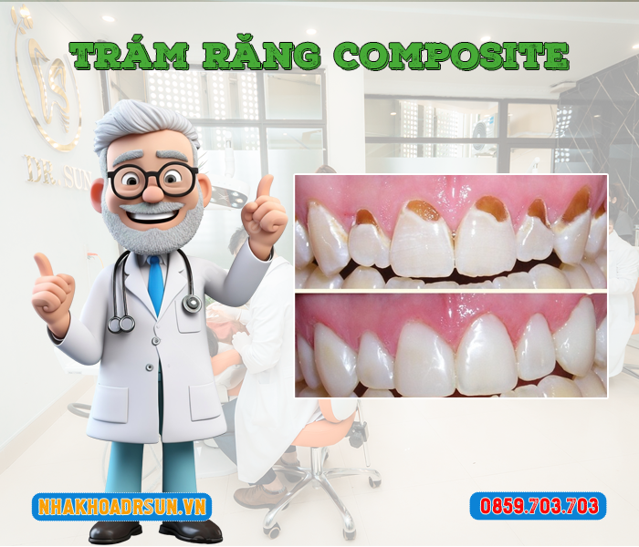 tram-rang-Composite