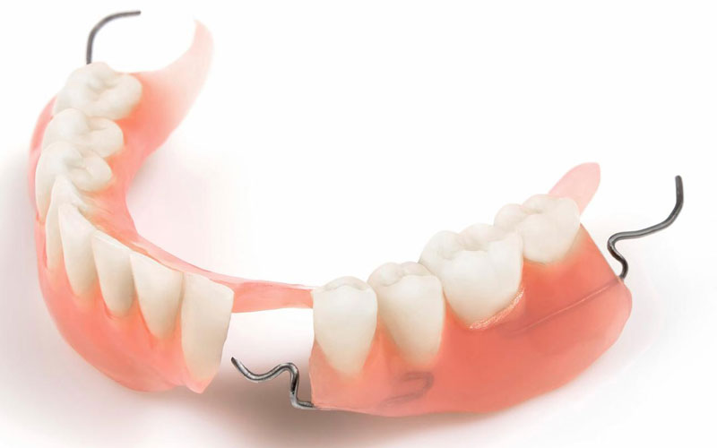 Giá trồng răng tháo lắp