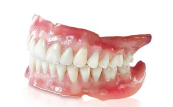 Trồng răng giả tháo lắp giá bao nhiêu? địa chỉ uy tín tại thái Nguyên