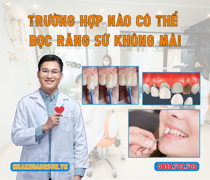 truong-hop-nao-co-the-boc-rang-su-khong-mai