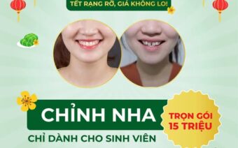 SINH VIÊN CHỈNH NHA – TẾT RẠNG RỠ, GIÁ KHÔNG LO!