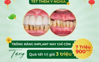 NỤ CƯỜI XINH TẾT THÊM Ý NGHĨA