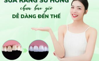 SỬA RĂNG SỨ HỎNG CHƯA BAO GIỜ DỄ DÀNG ĐẾN THẾ!