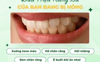 RĂNG SỨ CỦA BẠN CÓ ĐANG: