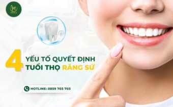 4 YẾU TỐ QUYẾT ĐỊNH TUỔI THỌ CỦA RĂNG SỨ