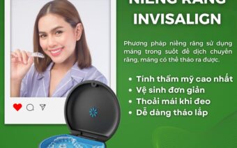 NIỀNG RĂNG – TẠM BIỆT RĂNG H.Ô – THƯ.A – MÓ.M – KHẤ.P KHỂNH