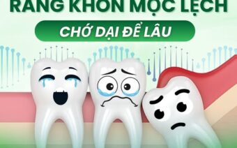 RĂNG KHÔN MỌC LỆCH: CHỚ DẠI ĐỂ LÂU