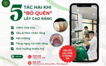 TOP 5 TÁC HẠI KHI ‘BỎ QUÊN’ VIỆC LẤY CAO RĂNG ĐỊNH KỲ!