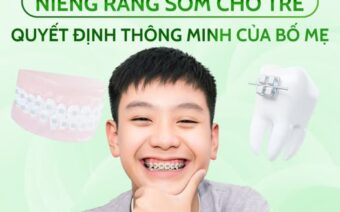 Niềng răng sớm cho trẻ – Quyết định thông minh của bố mẹ