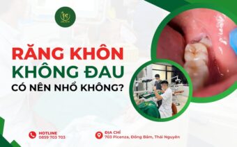 RĂNG KHÔN KHÔNG ĐAU CÓ NÊN NHỔ KHÔNG?