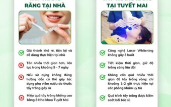 NÊN TẨY TRẮNG RĂNG TẠI NHÀ HAY TẠI NHA KHOA?