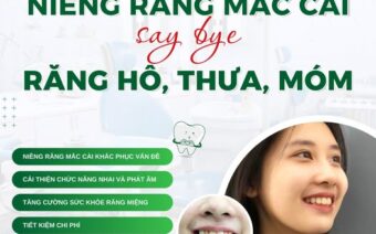 NIỀNG RĂNG MẮC CÀI: SAY BYE RĂNG HÔ, THƯA, MÓM!