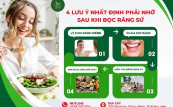 4 LƯU Ý NHẤT ĐỊNH PHẢI NHỚ SAU KHI BỌC SỨ