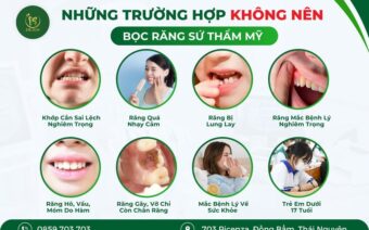 NHỮNG TRƯỜNG HỢP KHÔNG NÊN BỌC RĂNG SỨ THẨM MỸ