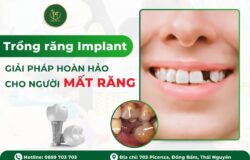 TRỒNG RĂNG IMPLANT – GIẢI PHÁP HOÀN HẢO CHO NGƯỜI MẤT RĂNG