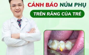 !!! CẢNH BÁO !!! TRÊN RĂNG CON CÓ TÌNH TRẠNG NÀY PHẢI ĐI KHÁM NGAY