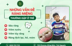 NHỮNG VẤN ĐỀ VỀ RĂNG MIỆNG THƯỜNG GẶP Ở TRẺ